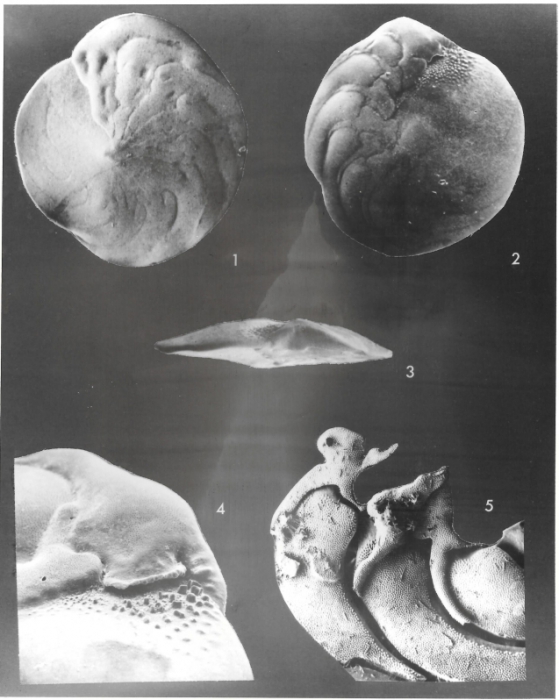 Amphistegina bicirculata Larsen, 1976 Amphistegina bicirculata Larsen, 1976