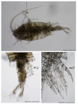 Centropages_australiensis_AusCPR