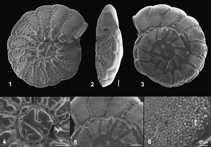 Ammonia beccarii (Linnaeus, 1758) Neotype, superceded by lectotype