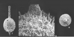 Pygmaeoseistron annulatacollare Loeblich & Tappan, 1994
