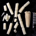 Crinoidea (sea lilies and feather stars)