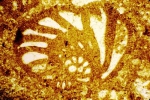 Pfenderina chablaisensis Septfontaine, 1977