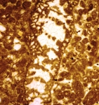 Alzonella cuvillieri Bernier & Neuman, 1970