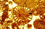 Meyendorffina bathonica Aurouze & Bizon, 1958