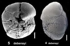 Ammonia debenayi Hayward and Holzmann, 2019 holotype, author: Hayward, Bruce W.