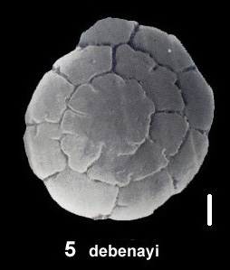 Ammonia debenayi Hayward and Holzmann, 2019 paratype Ammonia debenayi Hayward and Holzmann, 2019 paratype