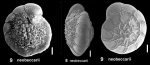 Ammonia neobeccarii Stshchedrina and Mayer, 1975 identified specimen