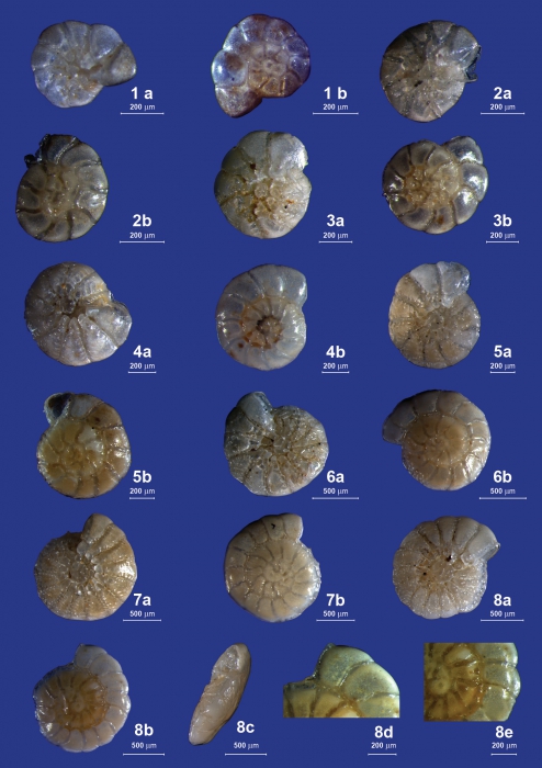 Ammonia beccarii neotype and topotypes Ammonia beccarii neotype and topotypes