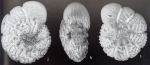 Ammonia rugulosa Parker, 2009 holotype