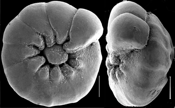 Ammonia sobrina (Shupak, 1934) identified specimen