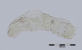 Chaetogaster setosus (Netherlands)