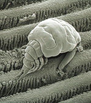 SEM of Ergasilus sieboldi on host gill SEM of Ergasilus sieboldi on host gill