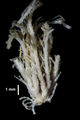 Crinoidea (sea lilies and feather stars)