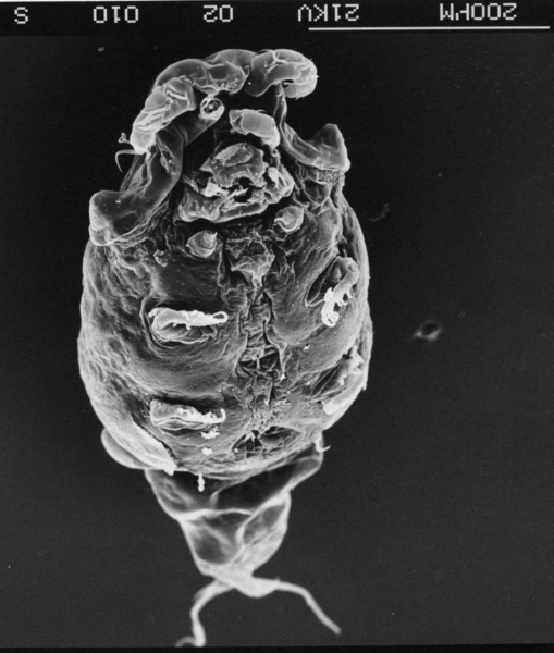 Gadilicola daviesi SEM of adult female Gadilicola daviesi SEM of adult female