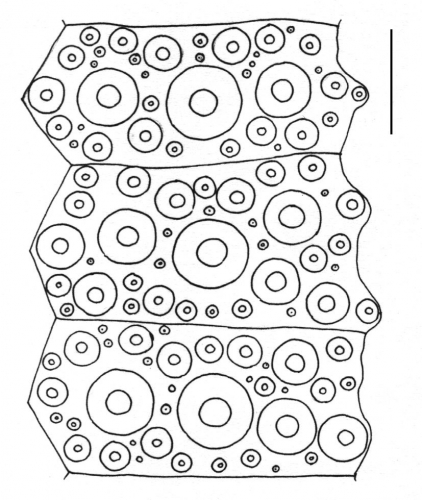 Pachycentrotus australiae (interambulacral plates) Pachycentrotus australiae (interambulacral plates)