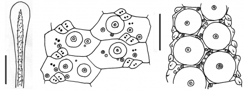 Phormosoma placenta (spine + ambulacral plates)