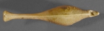 Echinosigra phiale (aboral)