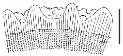 Phyllacanthus parvispinus (primary spine, transverse section)