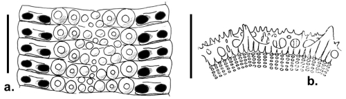 Stereocidaris microtuberculata (ambulacral plates + spine section)