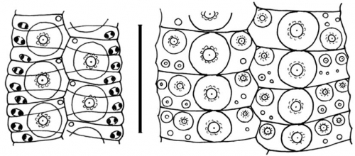 Centrostephanus asteriscus (plating)