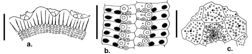 Hesperocidaris panamensis (ambularal plates, apical disc and spine cross section)