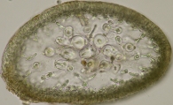 Catenella caespitosa, author: Ignacio Bbara