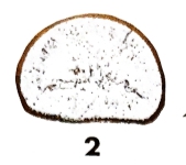 Eotuberitina fornicata Hallett, 1971 Eotuberitina fornicata Hallett, 1971