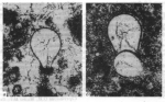Eotuberitina reitlingerae subsp. piriformis Sabirov, 2004