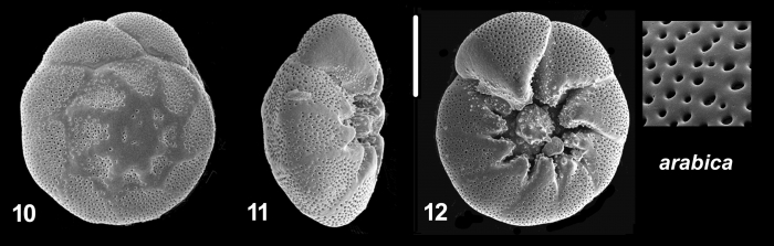 Ammonia arabica Kaushik, 2021 Holotype Ammonia arabica Kaushik, 2021 Holotype