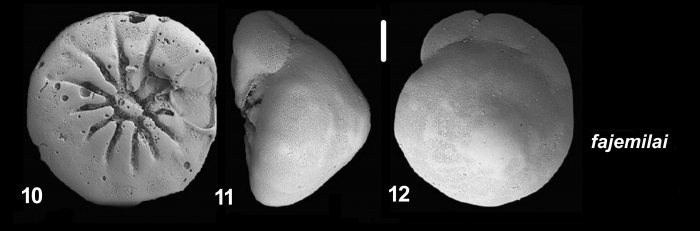 Ammonia fajemilai Hayward and Holzmann, 2021 Holotype Ammonia fajemilai Hayward and Holzmann, 2021 Holotype