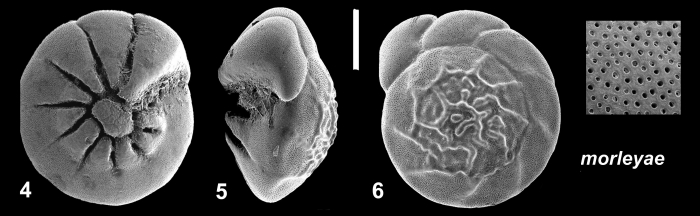Ammonia morleyae Hayward and Holzman, 2021 Holotype Ammonia morleyae Hayward and Holzman, 2021 Holotype