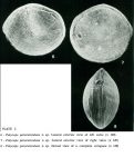 Polycope parareticulata Bonaduce, Ciampo & Masoli, 1976 from the original description