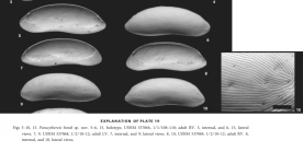 Paracytherois bondi Yasuhara, Okahashi & Cronin, 2009 from the original description