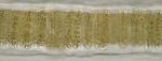Protozoa
