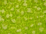 Protozoa