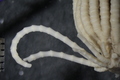 Crinoidea (sea lilies and feather stars)