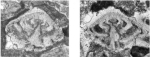 Rotorbinella skourensis (Pfender, 1938)