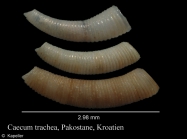 Caecum trachea