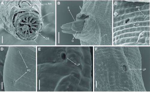 Pomponema longispiculum Pomponema longispiculum