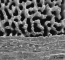 Bathypsammia tintinnabulum, hispid theca, author: Cairns, 2001, Figure 4e, page 55