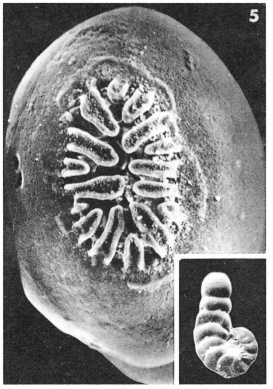 Spirolina laevigata d'Orbigny, 1850 Spirolina laevigata d'Orbigny, 1850