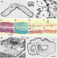 Yoda demiankoopi Holland, Hiley & Rouse, 2022, author: Schmidt Ocean Institute