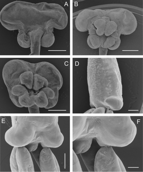 Tripaphylus squidwardi Boxshall, Barton, Kirke, Zhu & Johnson, 2022 Tripaphylus squidwardi Boxshall, Barton, Kirke, Zhu & Johnson, 2022