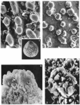 Globulina gibba subsp. punctata d'Orbigny, 1846