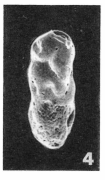 Uvigerinella abbreviata (Terquem, 1882) Uvigerinella abbreviata (Terquem, 1882)