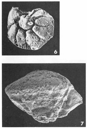 Pararotalia inermis (Terquem, 1882) Pararotalia inermis (Terquem, 1882)