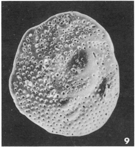 Eponides polygonus Le Calvez, 1949 Eponides polygonus Le Calvez, 1949