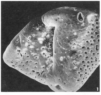 Eponides polygonus Le Calvez, 1949 Eponides polygonus Le Calvez, 1949