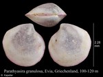 Parathyasira granulosa