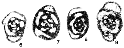 Neoseptaglomospiranella dainae (Lipina, 1955) Neoseptaglomospiranella dainae (Lipina, 1955)
